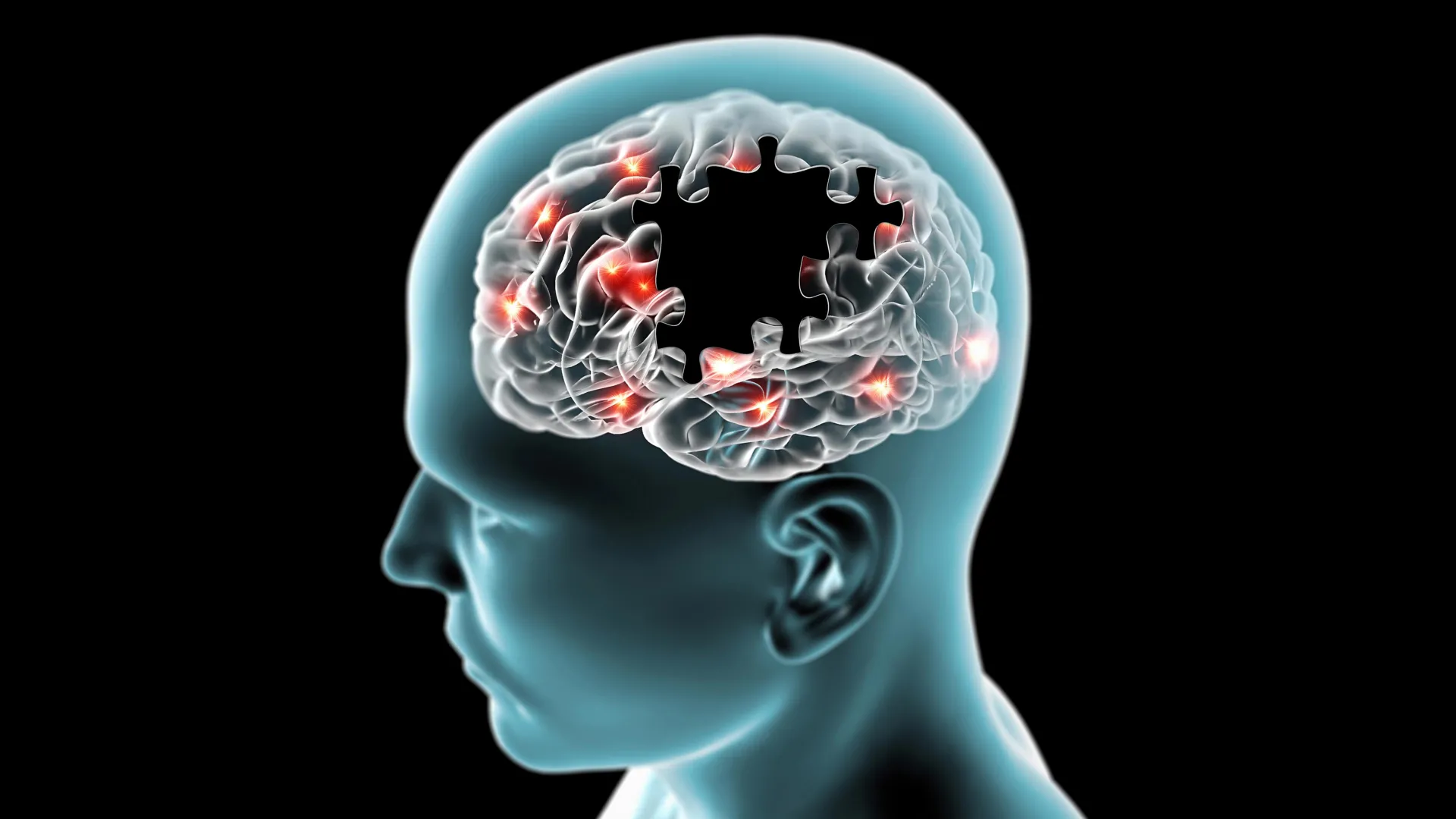 The Rhythm of Thought: How Artificial Intelligence is Decoding Brain Health Through Everyday Speech