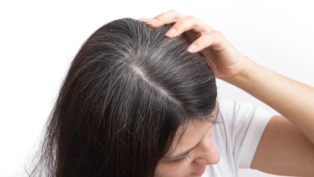 Grey Hair and Cancer: Debunking a Pervasive Myth with Scientific Clarity